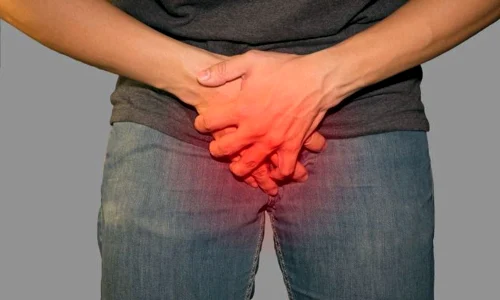 variola genitale jpg