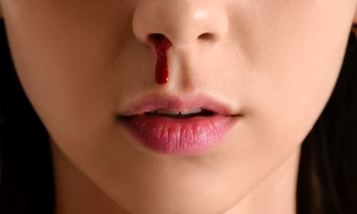 nas sangerare  shutterstock 2205506727 jpg