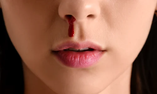 nas sangerare  shutterstock 2205506727 jpg