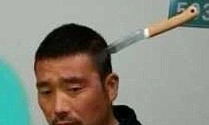 A ajuns cu un cutit in cap la spital jpeg