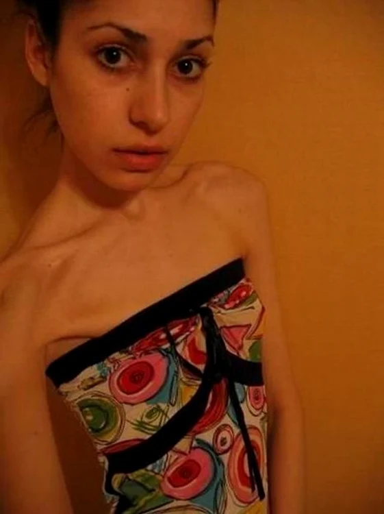 Anorexicele sunt sexy?