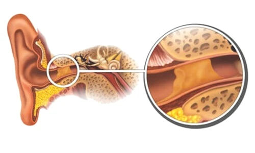 1 68061 original jpg jpeg