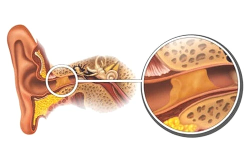 1 68061 original jpg jpeg