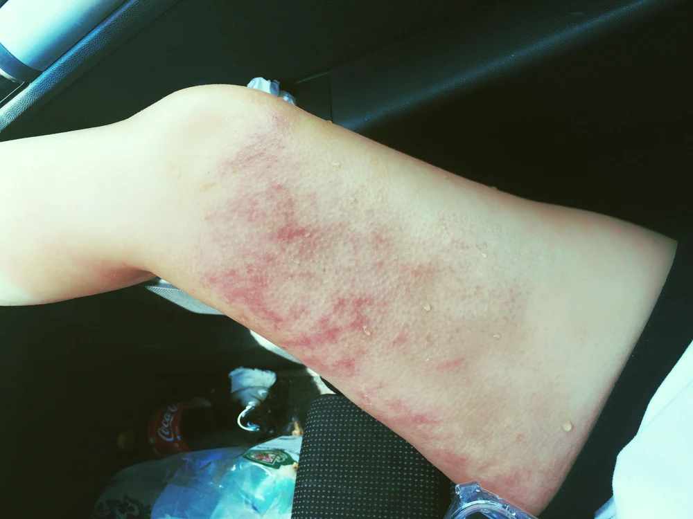 
    Cristina Vasiu s-a accidentat la filmările clipului „Scurtmetraj”, pe care l-a realizat împreună cu rapp-erul DiezZfoto: arhiva personală  