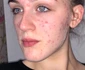 2 15230974 7179469 lucy heyes 19 from liverpool has praised a 6 cleansing bar conta a 55 1561472511564 jpg jpeg