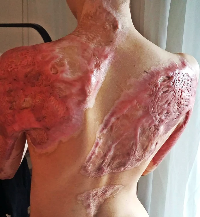 Trupul Alexandrei este încă o rană care îi provoacă suferinţă