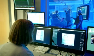 angiograf cardiovascular jpeg