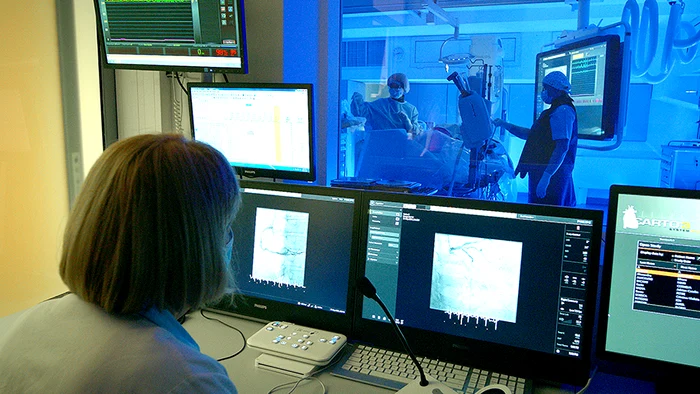 Angiograf cardiovascularfoto: Sanador