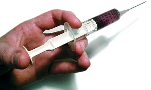 ce este puncţia jpeg