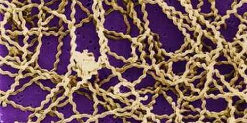 Satu Mare: Patru cazuri de leptospiroză