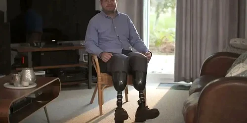 neil hopper chirurgul britanic care si a amputat picioarele pentru a obtine despagubiri din asigurarea medicala foto X jpg