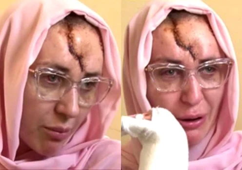 Dana Roba a fost bătută cu bestialitate de către soțul său. Sursă: Facebook