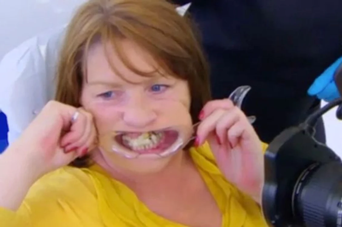 
    Femeia era atât de speriată de dentist încât și-a lipit dintele la locfoto: captură video  