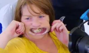 dinte lipit cu superglue jpeg