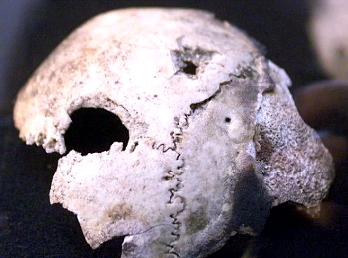 Ani de zile s-a crezut că acesta este craniul lui Hitler