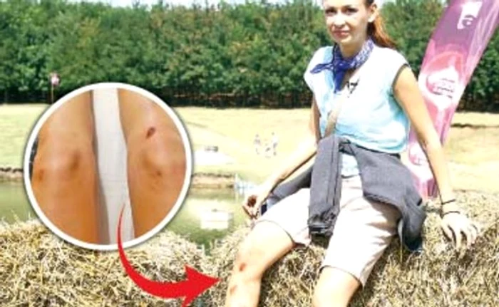 Jumătatea trupei Bambi s-a ales cu picioarele distruse, pline de zgârieturi