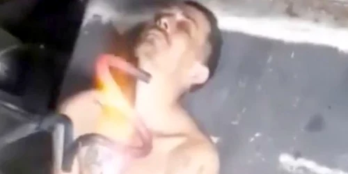 rusii îşi imprima simbolul z pe corp cu ajutorul unui fier incins FOTO Twitter