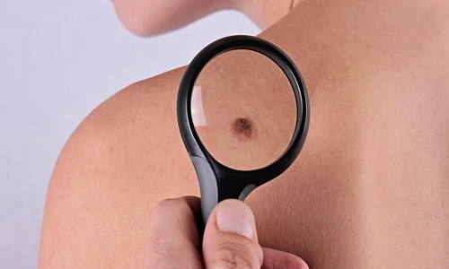 1 85158 original jpg jpeg