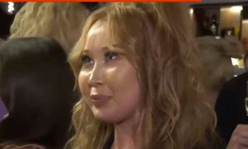 Xonia susține că fața ei umflată se datorează unei afecțiuni medicale jpeg