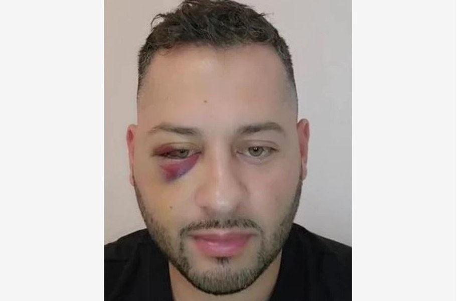 Fostul preot Daniel Balaș, bătut crunt în trafic după o șicanare. „Mi-au provocat trei fracturi, la maxilar, sinusuri și la osul de sub ochi”