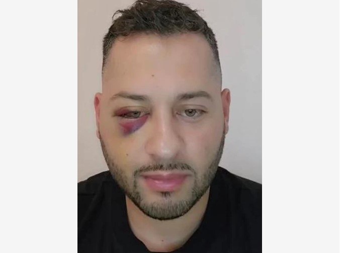 Un fost preot a fost bătut grav în trafic, după o șicanare. Un fost preot a fost bătut grav în trafic, după o șicanare.