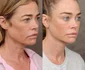 Denise Richards lifting, Foto Instagram