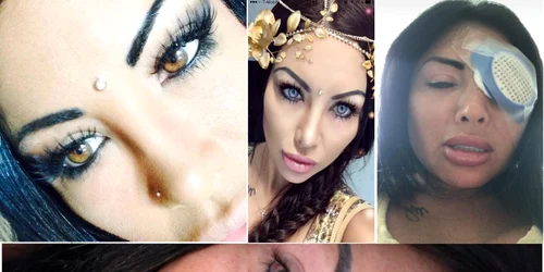 Un model de Instagram Naddine Bruna a rămas parțial oarbă în urma schimbării culorii ochilor Colaj Glasgowtimes