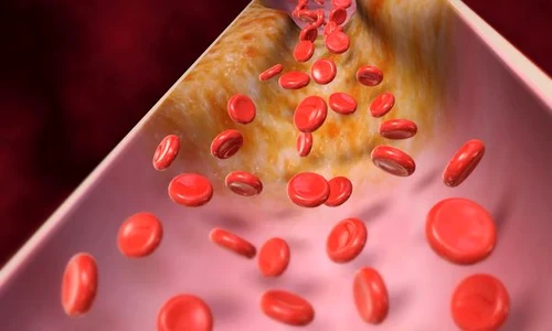 celule sange 600x414 jpeg