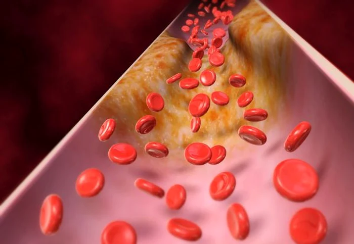 Acest remediu natural reduce colesterolul și acționează împotriva hipertensiunii arteriale.www.clickpentrufemei.ro
