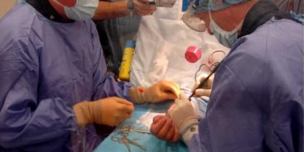 India: Unei femei i-a fost extirpată o tumoare uterină de 4,9 kilograme