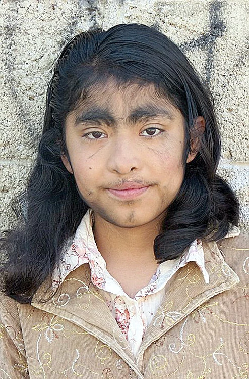 Araceli (12 ani) strică  5 aparate de ras pe zi