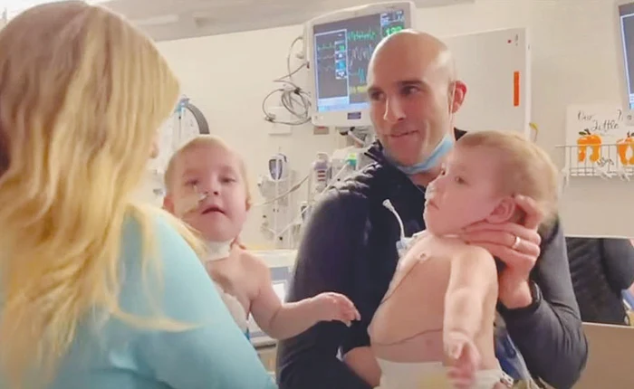 Addy şi Lily au fost separaţi după o operaţie de 10 ore