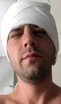 Adrian Nartea, după operația avută în urmă cu cinci ani. Sursa foto: Click!