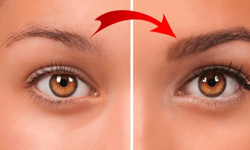 Te ai pensat prea mult, iar acum nu îţi mai cresc sprâncenele?  png