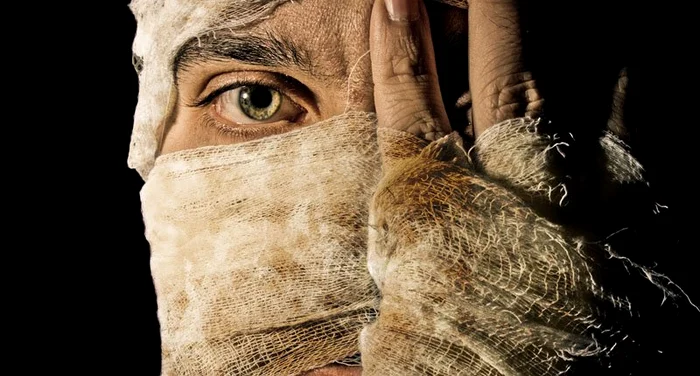 
    Pippie, după operaţia de transplant de piele. Fata are acum şase ani şi refacerea decurge aşa cum trebuieFoto: Rex Features  