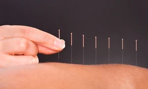 1 efectele benefice ale acupuncturii jpg jpeg