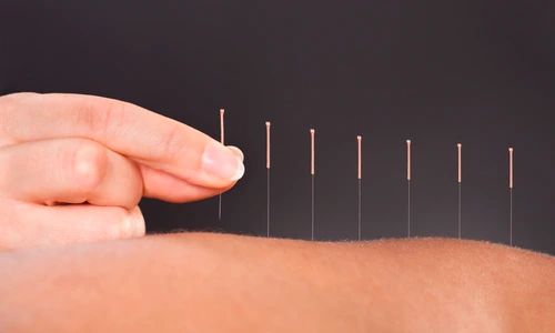 1 efectele benefice ale acupuncturii jpg jpeg