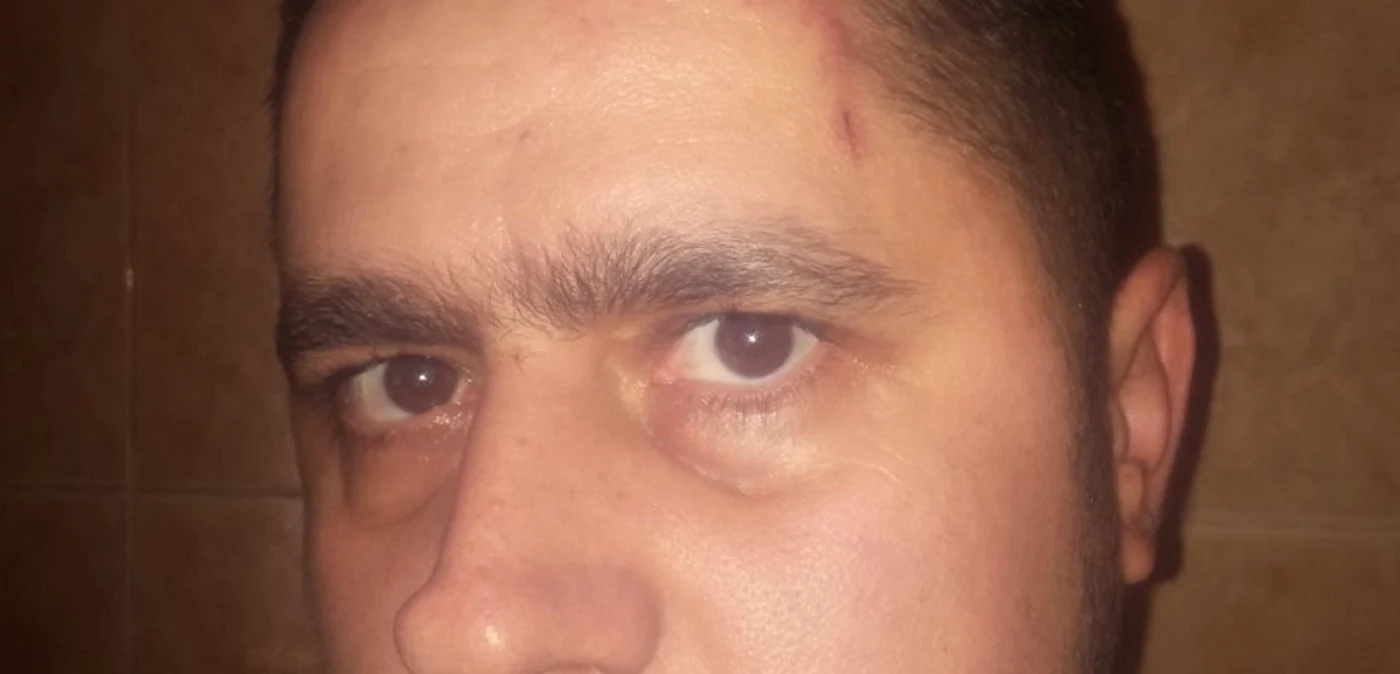 Ionuţ Bălan, bărbatul confundat cu cel care a comis jaful, spune că a primit mai multe lovituri în cap de la oamenii legii