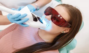 albire dentara cu laser procedura sigura i eficienta pentru un zambet stralucitor jpg