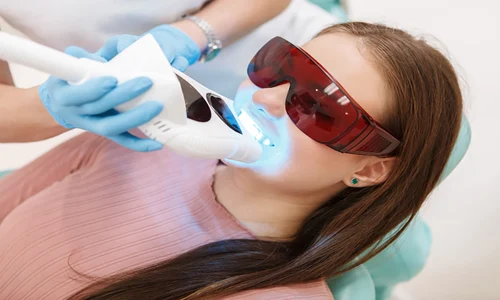 albire dentara cu laser procedura sigura i eficienta pentru un zambet stralucitor jpg