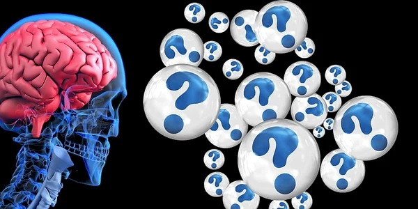 1 brain question mark alzheimer s dementia jpg jpeg