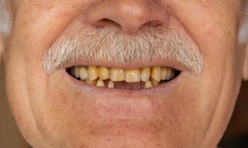 image png