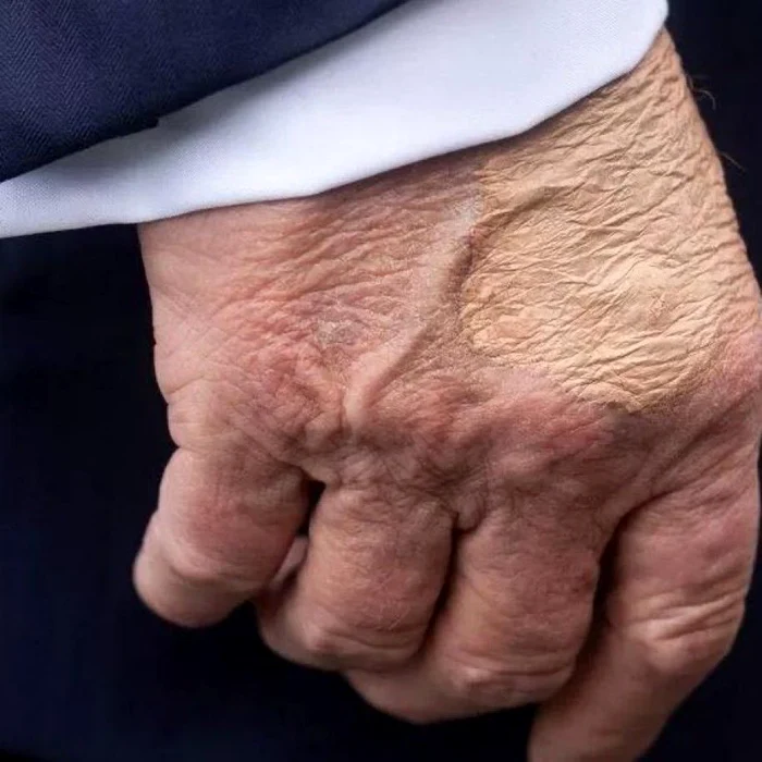 Fotografie cu mâna dreaptă a președintelui SUA FOTO: X