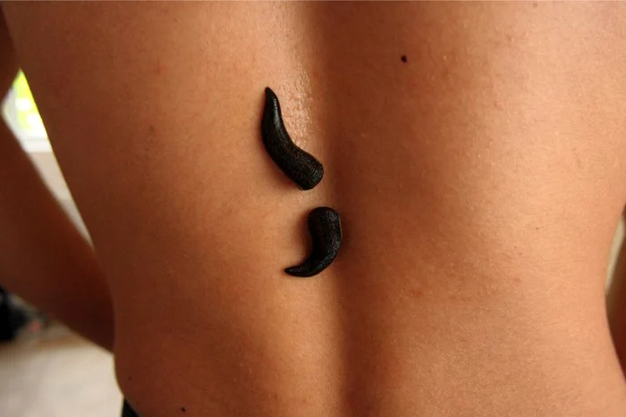 
    Terapia cu lipitori sau hirudoterapia are o vechime  milenară. (Foto arhivă Click!)  