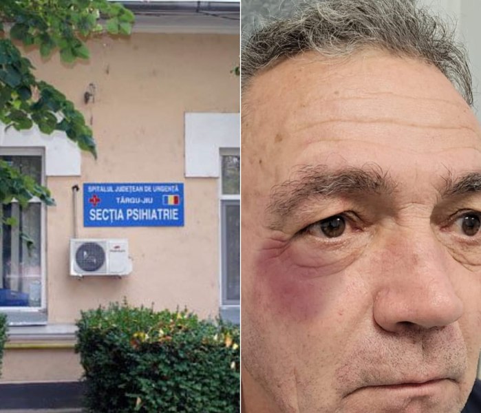 Scandal în Secția de Psihiatrie din Târgu Jiu. Un agent de pază susține că a fost bătut de un asistent medical