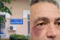 sectia de psihiatrie tg jiu jpeg