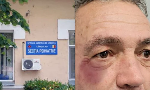 sectia de psihiatrie tg jiu jpeg