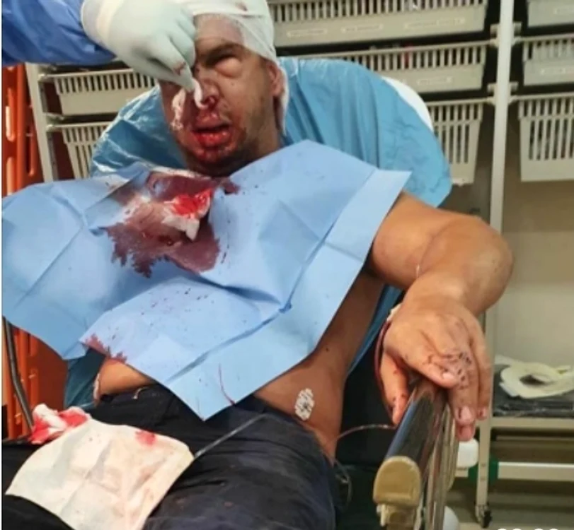 Călin, fratele Alinei Pană, a fost la un pas să fie ucis