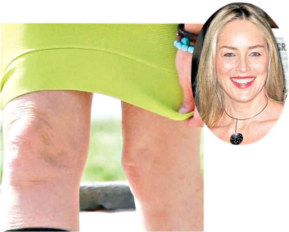 Sharon  Stone