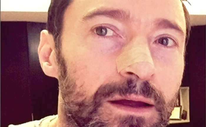 
    2016. Starul este  bandajat după a  cincea operaţieFoto: Instagram  